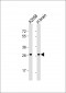 OR4F17 Antibody (N-term)